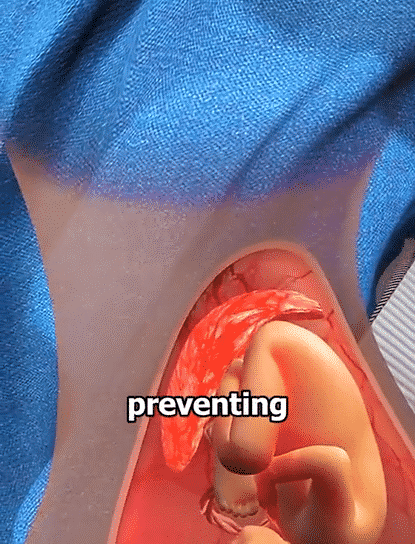 Pregnant Women Driving Seat Belts for Abdominal Comfort and Safety